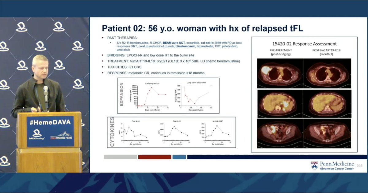 Dr. Jakub Svoboda @PennMedicine discusses armored huCART19-IL18 with encouraging early results in CD19+ lymphoma No new safety signals w/ IL-18 CRS/ICANS rates comparable, reversible 82% ORR at 3 mo Enrollment completed for NHL and continues for CLL, ALL clinicaltrials.gov/study/NCT04684…