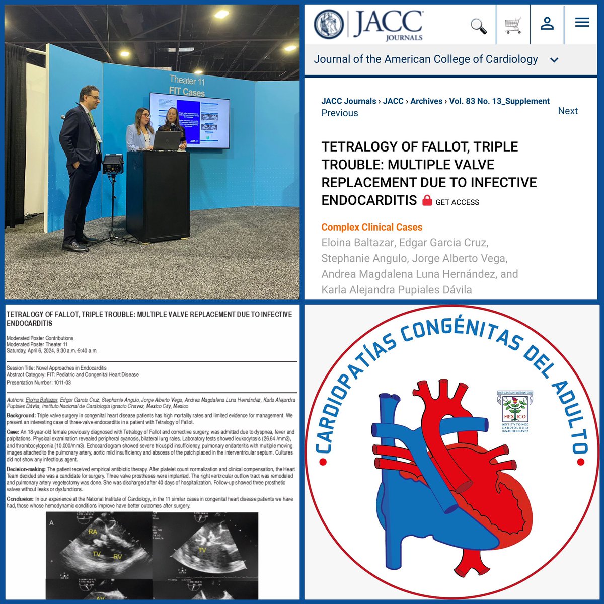 Complex case of ACHD presented in the #ACC2024. Congratulations to @BaltazarEloina for representing the ACHD clinic Instituto Nacional de Cardiología Ignacio Chavez @Cardio_ciencias @JohnJairoArauj1 @stephy2611 @KarlaPupiales @carlos_sierra @smexcardiologia @SOME_IC