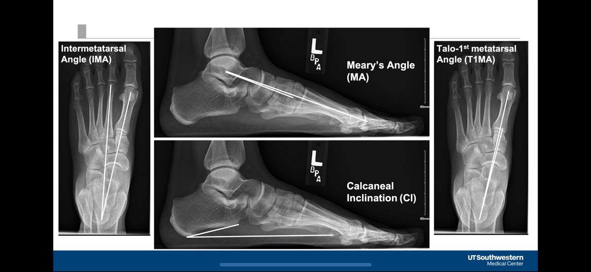 Henry Ellis (@henryellismd) on Twitter photo Congrats to Huy Do for winning residents research award at TOA annual leadership meeting. He further supported the value of looking at the contralateral side. <a href="/utswortho/">UTSW Orthopaedic Surgery</a> <a href="/TXOrthoAssn/">TX Orthopaedic Assn</a> Congrats to Huy Do for winning residents research award at TOA annual leadership meeting. He further supported the value of looking at the contralateral side. <a href="/utswortho/">UTSW Orthopaedic Surgery</a> <a href="/TXOrthoAssn/">TX Orthopaedic Assn</a>