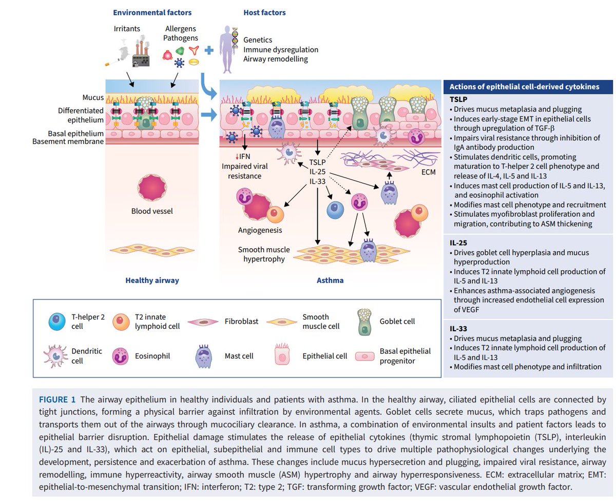 Epithelial dysfunction is a key contributor in asthma pathology. Here is a great review on the role of epithelial #cytokines in #asthma. bit.ly/48lEX1a