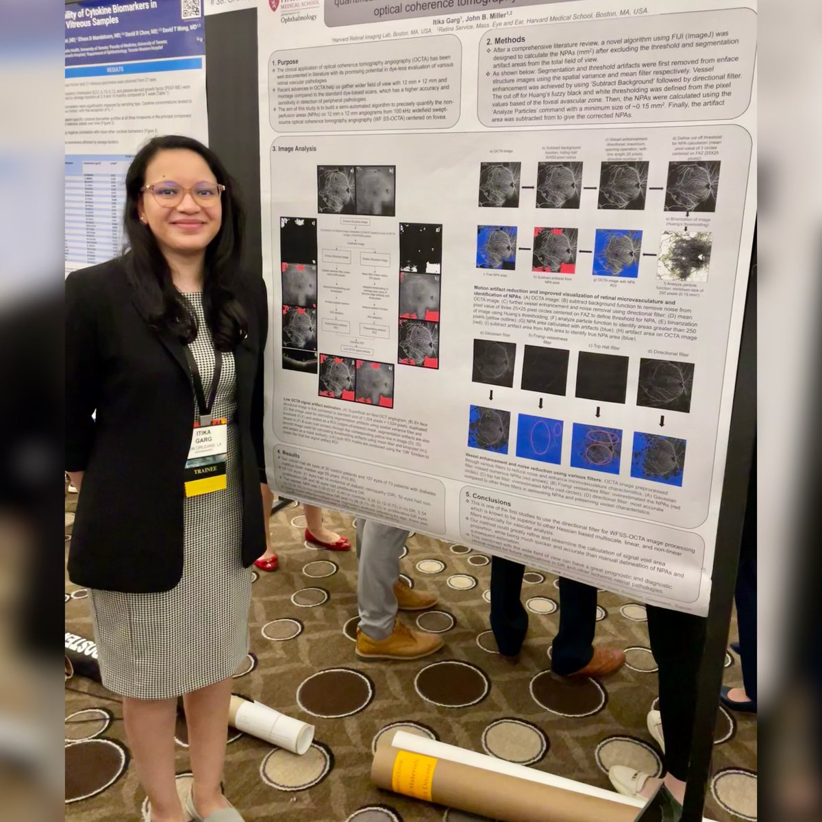 Itika Garg, MD (@itikagarg) on Twitter photo First VBS presentation ✅ Enjoyed presenting our work on #nonperfusion in #WFSSOCTA <a href="/JohnBMillerMD/">John B. Miller</a> at <a href="/VitBuckleSoc/">VBS - Vit Buckle Society</a> <a href="/VitBuckle/">VBS</a> 2024 meeting! Fantastic meeting with interesting sessions on personal well being as well as surgical retina! 👁️🌟#strangervits #HarvardRetinalImagingLab First VBS presentation ✅ Enjoyed presenting our work on #nonperfusion in #WFSSOCTA <a href="/JohnBMillerMD/">John B. Miller</a> at <a href="/VitBuckleSoc/">VBS - Vit Buckle Society</a> <a href="/VitBuckle/">VBS</a> 2024 meeting! Fantastic meeting with interesting sessions on personal well being as well as surgical retina! 👁️🌟#strangervits #HarvardRetinalImagingLab