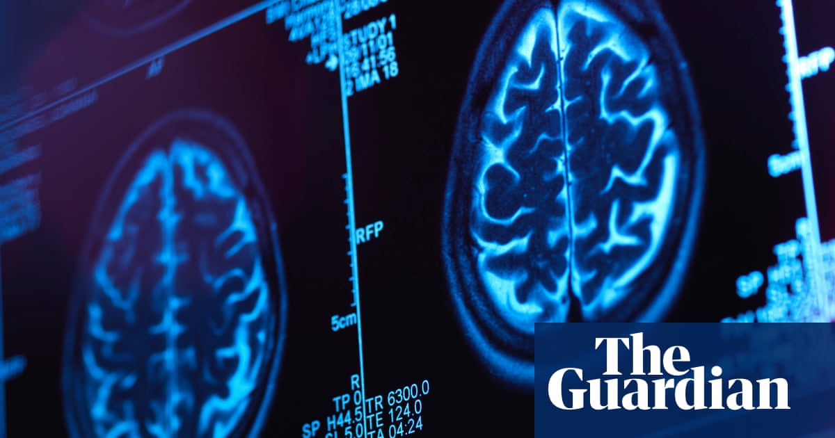 Detecting early onset frontotemporal dementia? There's an app for that. Researchers hope that eventually these smartphone assessments 'will facilitate new trials of promising therapies.' bit.ly/43JrfV9