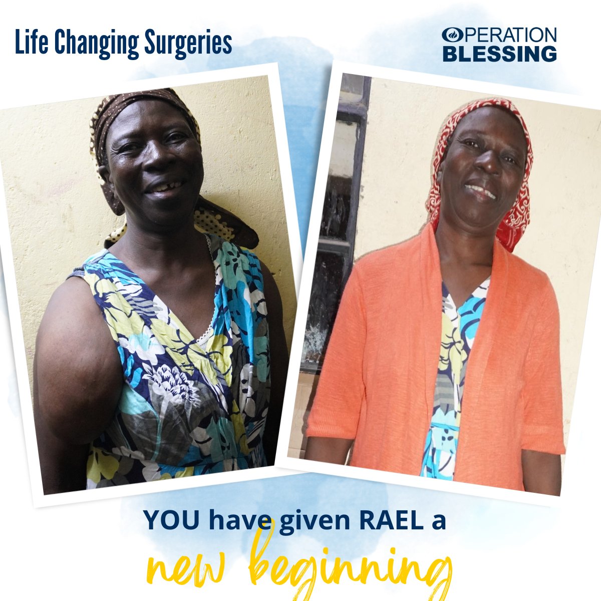 Thanks to friends like you, Rael in Kenya had surgery to heal the lipoma in her arm. She can fit into her clothes and work again to support her family. Plus, you have restored her confidence! Thank you for making a difference through #LifeChangingSurgeries!