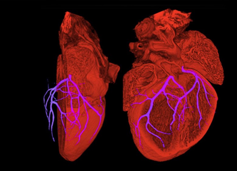 On #WorldHealthDay find out more about our lifesaving research: bhf.org.uk/what-we-do/our… From 3D printed hearts and internal defibrillators to regenerative medicine, we have helped improve and save the lives of many people with heart and circulatory diseases.