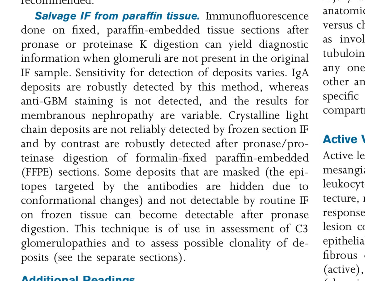 🤔Clinical pearl in Kidney biopsy 👍Always do Paraffin IF➡️Pronase digestion and unmasking 🎯It might unmask Immunoglobulins/Complements-In C3 GP 👉Also a saviour when glomeruli are inadequate in IF sample ajkd.org/article/S0272-… @AJKDonline @RitambhraN