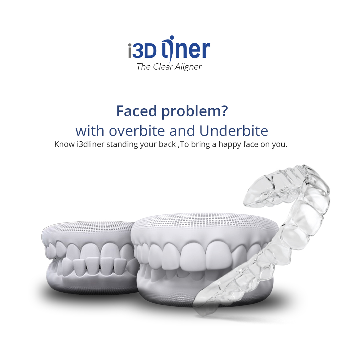 I3dLiner's tweet image. Faced problem? with overbite and Underbite?

know i3dliner standing your back ,To bring a happy face on you 
Why delay go fast and consult your near clinic for i3dliner

#i3dliner #i3dlinermagic #clearaligners #teethstraitening #orthodontics #foodlover #fashion #smartdentalclinic