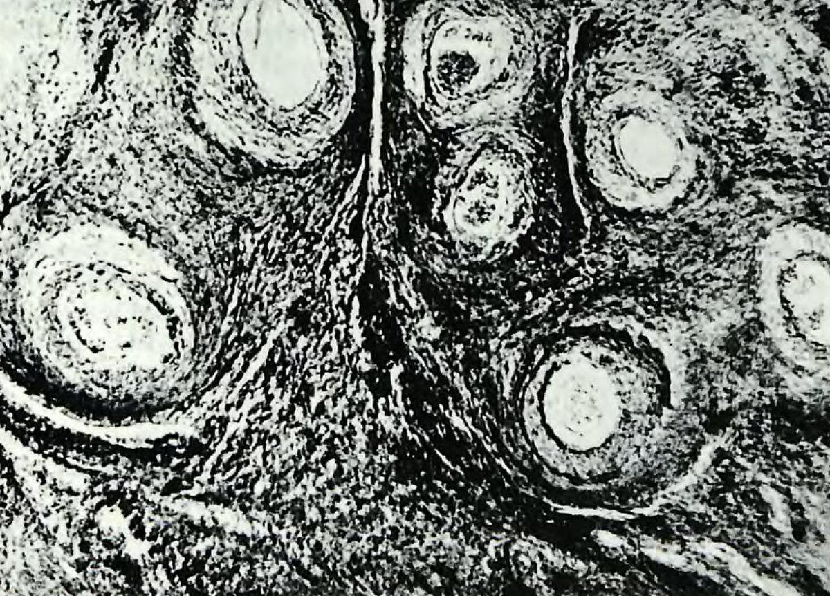 Is this a combination of The Scream by Munch and Starry Night by van Gogh? (No, it's actually a cross-section of a fin whale ovary, Slijper 1966)