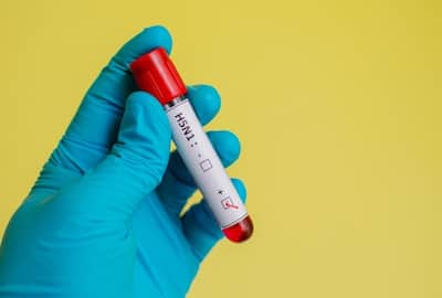 🗺️ #BirdFlu / Influenza A H5N1.
Bird, Cattle and Human infections.
What we know and what we don't . Should we be worried ?
A short🧵with explainer .