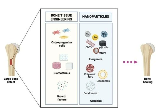 📢 Just published: The 9th paper in our Special Issue 'Multidisciplinary Insights on Bone Healing', explores nanotechnology's impact on Bone Tissue Engineering. 🔗 mdpi.com/2737582 🧐 For more insightful papers, delve into the #SpecialIssue at: mdpi.com/si/157277