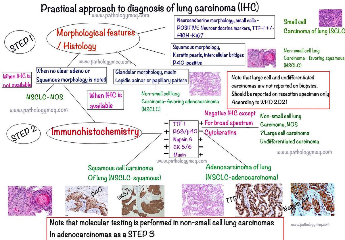 Algorithmic approach to lung carcinoma- IHC Based
Reference WHO Tumors of lung and pleura-2021
