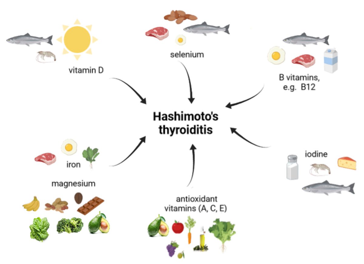 #notablepaper 🏆Top Download in 2022 📚Metabolic Characteristics of Hashimoto’s Thyroiditis Patients and the Role of Microelements and Diet in the Disease Management—An Overview 🔗mdpi.com/1675000 👨‍🔬By Prof. Franciszek K. Główka et al @MDPIOpenAccess @MDPIBiologySubj
