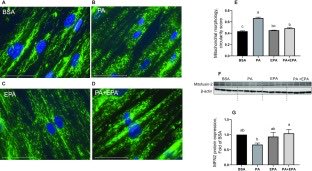 The Inhibition of Metabolic Inflammation by EPA Is Associated with Enhanced #Mitochondrial Fusion and Insulin Signaling in Human Primary Myotubes;

sciencedirect.com/science/articl…