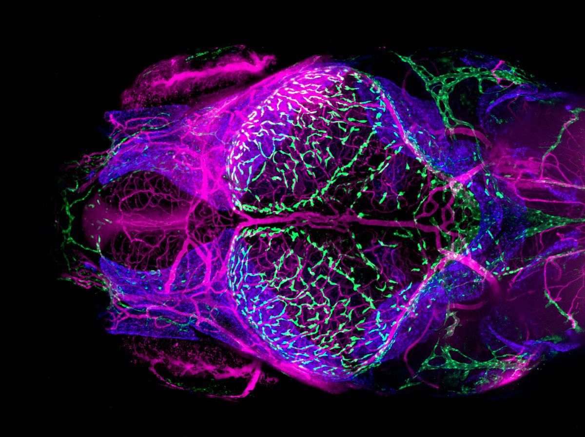 ZebrafishRock's tweet photo. Intracranial lymphatic vessels in a larval zebrafish. Credit to @dancastranova. #ZebrafishZunday https://t.co/usM7uYpnaR