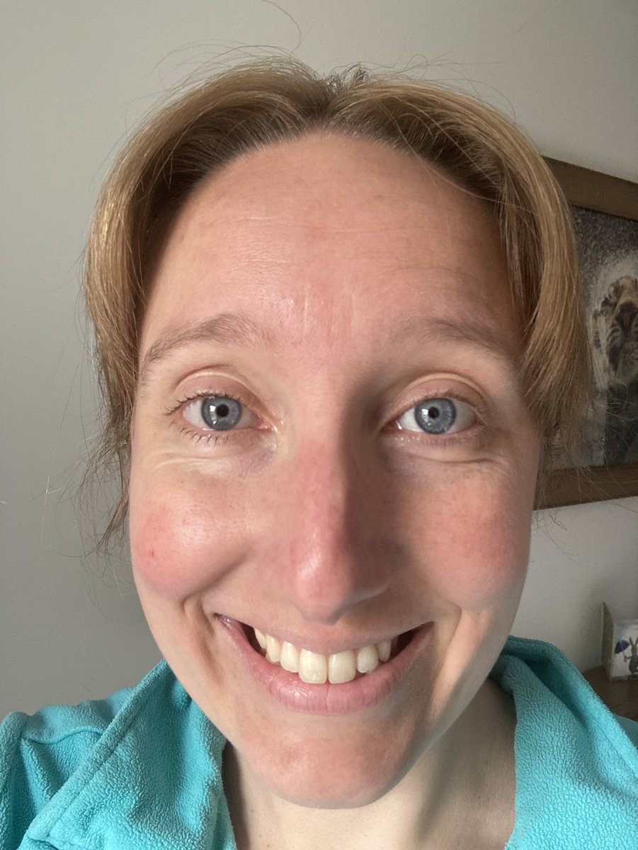 My eye is looking & feeling almost normal & I am starting to get the vision back. I cannot tell you how relieved & grateful I am right now! 🙏🏻 (Excuse the #NoMakeupSelfie- I haven’t worn makeup for a whole month. 😂) Aiming for fit & healthy Zen Jen from now on. 🏊🏻‍♀️🚴🏼‍♀️🏃🏼‍♀️🧘🏻‍♀️🍎🍓🥑