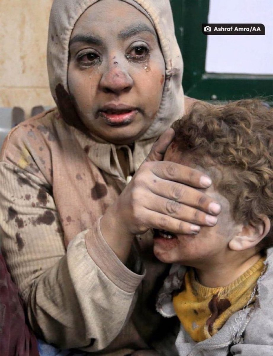 A Palestinian mother covers her son’s eyes as he gets raw treatment at Al-Aqsa Martyrs Hospital after the israelis bomb them in Deir al-Balah