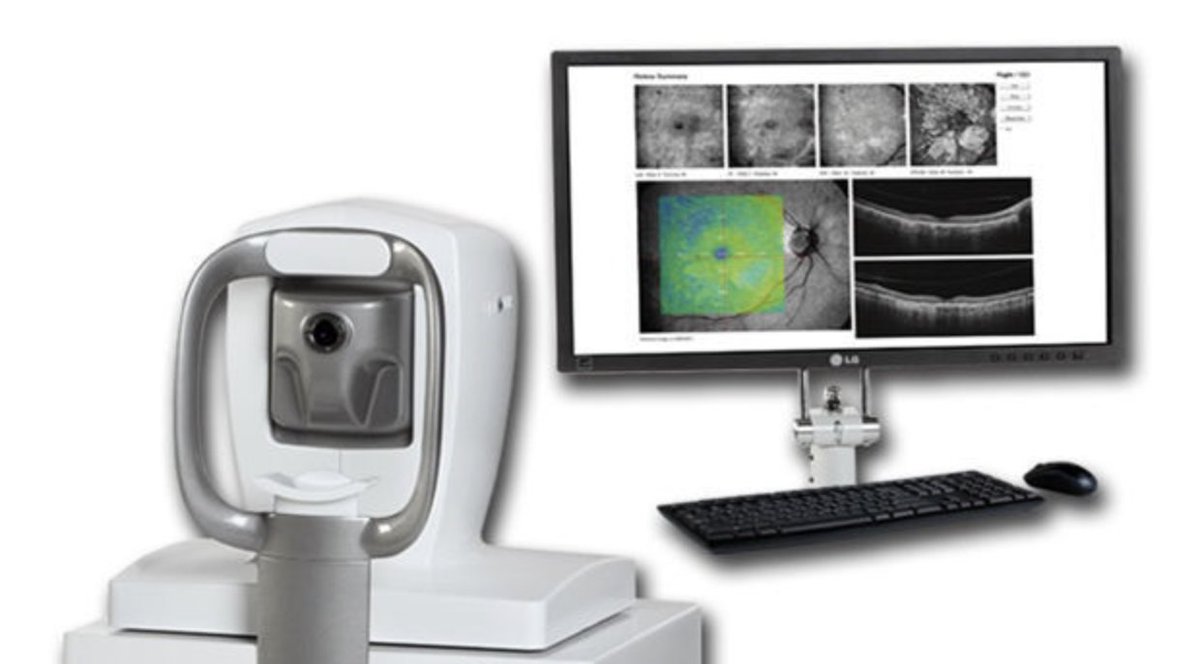 Did you know that the retina is part of the central nervous system (CNS)? And that you can measure subtle neuronal changes by imaging it? You can do this with optical coherence tomography (OCT) within a few minutes.