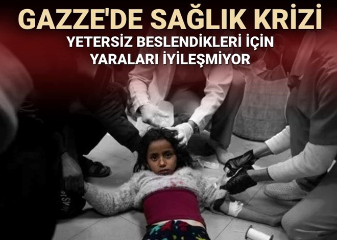 GAZZE'DE SAĞLIK KRİZİ Yetersiz beslendikleri için yaraları iyileşmiyor ntv.com.tr/dunya/gazzede-… Foto: NTV