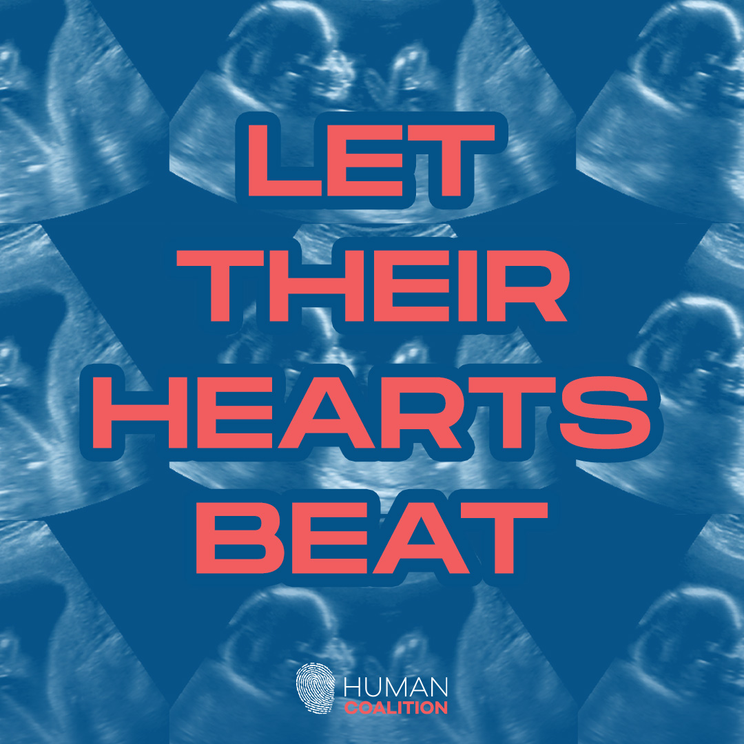 True love puts others first. It requires self-sacrifice, not self-interest. True love invites us to serve others, especially the most marginalized and helpless in society. This is our calling, and yes, it sometimes involves hardship. #SaveTheBabyHumans