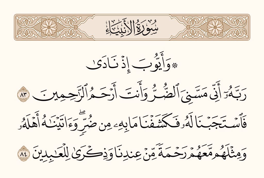 ﴿وَذِكرى لِلعابِدينَ﴾

أي : وجعلناه في ذلك قدوة لئلّا يظن أهل البلاء أنما فعلنا بهم ذلك لهوانهم علينا، وليتأسّوا به في الصبر على مقدورات الله وابتلائه لعباده بما شاء.

- ابن كثير