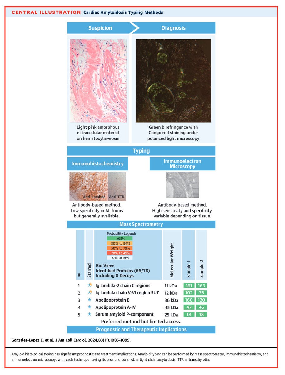 🔴 Histological Typing in Patients With Cardiac Amyloidosis @JACCJournals #Amyloidosis #CardioEd #Cardiology #FOAMed