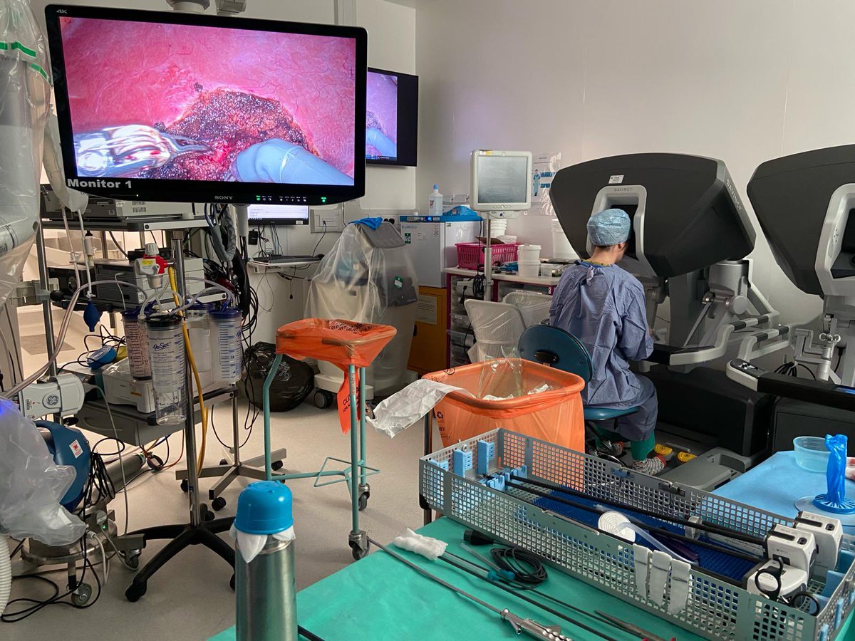 I was fortunate enough to assist our fellow Esther Platt during a 🤖 liver resection which was the first case on our new 4th Xi @RoyalSurrey 🥳! We’ve also passed 500 🤖 HPB cases in the last few weeks @GuildfordHpb @IHPBA @AHPBA @EAHPBA @roux_group