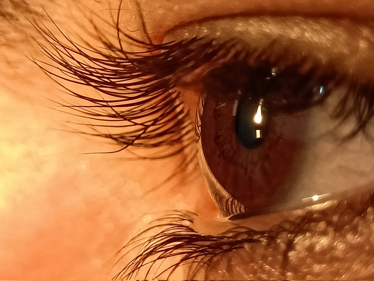My eyes 👀