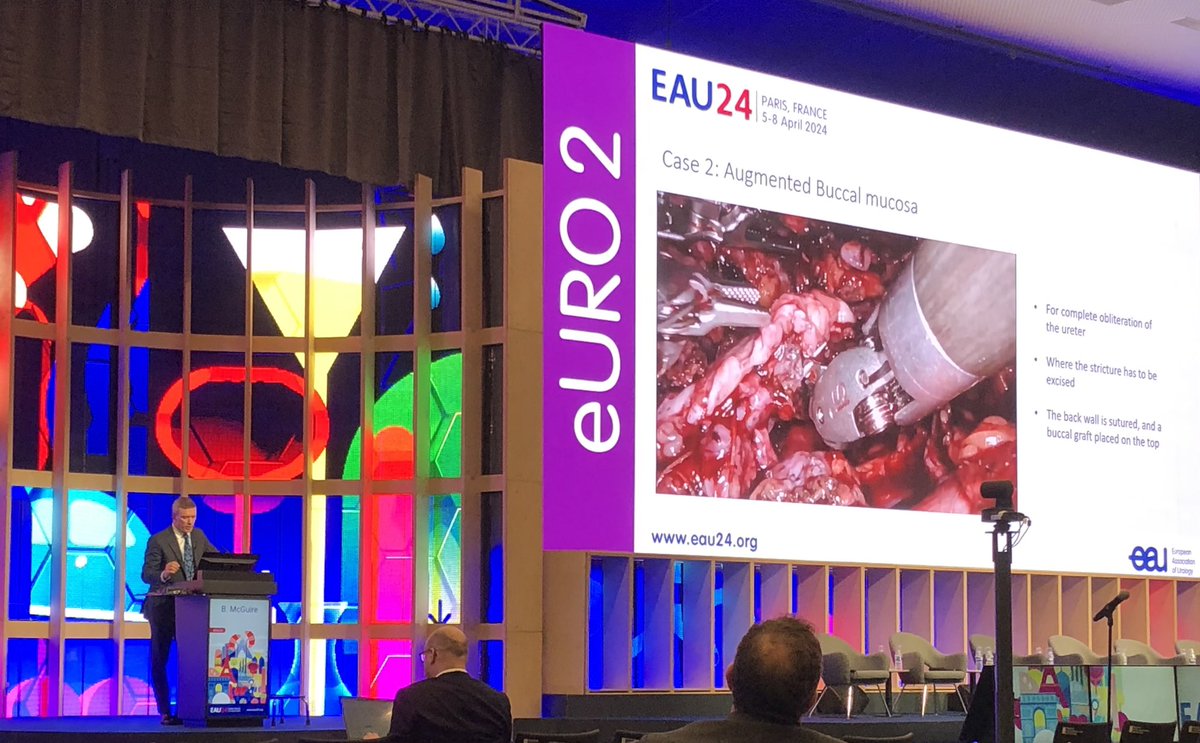 Beautiful demonstration of proximal ureteric stricture robotic reconstructive options by @bmcg22 #EAU24