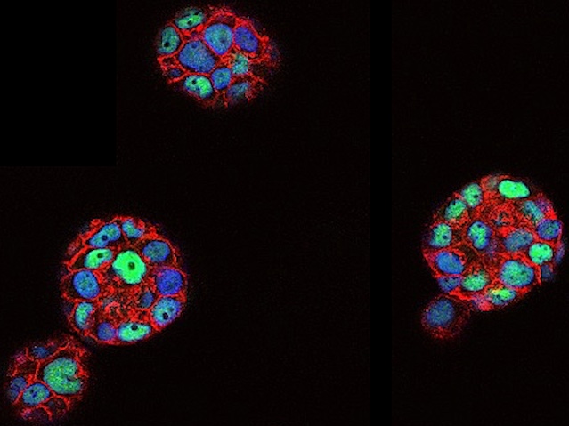 Molecular &amp; physical differences of #breastcancer cells grown in 2D vs 3D:  #spheroids have eg. more compact chromatin &amp; distinct downregulated #genes. Image &amp; research by Julieta Ramirez Cuellar, Roberto Ferrari et al <a href="/gpvicent/">Guillermo Vicent</a>  <a href="/_BIST/">BIST-Barcelona Institute of Science and Technology</a> in <a href="/embojournal/">The EMBO Journal</a>. On bpod.org.uk/archive/2024/4…