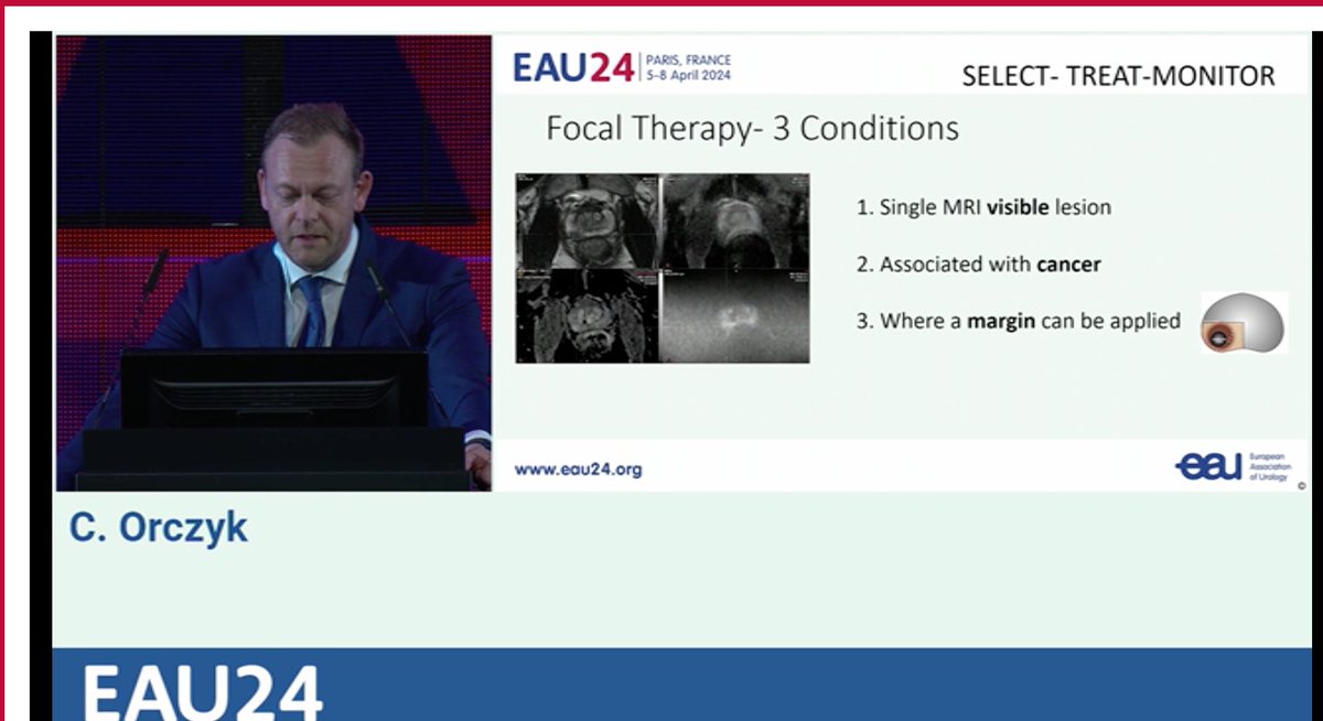 Live at #EAU24, focal therapy in prostate cancer, C. Orczyk presents the selection criteria highlighting the importance of MRI visibility, single lesion, and margin application. #ProstateCancer #FocalTherapy