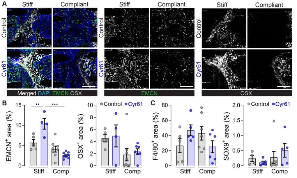 Our latest preprint, from <a href="/AmiLang_Science/">Annemarie Lang</a>, is live today <a href="/biorxivpreprint/">bioRxiv</a>!

Cyr61 delivery promotes angiogenesis during bone fracture repair.

biorxiv.org/cgi/content/sh…