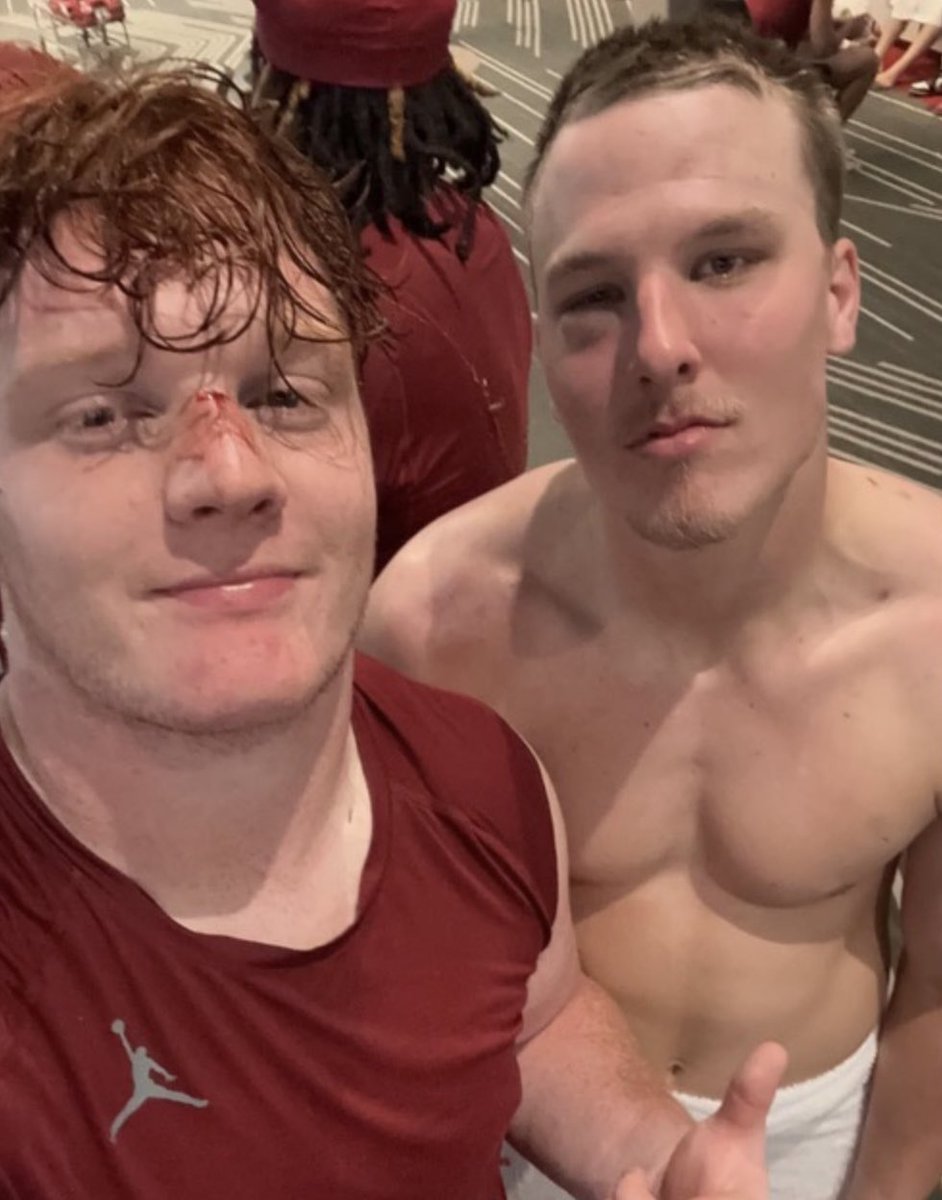 mozaeta's tweet image. You should see the other guys. #SpringPractice #OUDNA