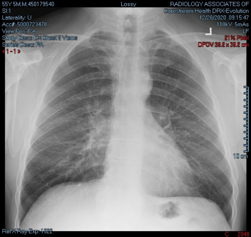 CanUTguy's tweet photo. @angie_rasmussen @KotakPreet @KHardwickFranco
@drmarcspooner @AOgieglo @KatharineSmart
@DrKyle @courosa Would you call this a Normal
x-ray with no problems? https://t.co/txP3SdiTIt