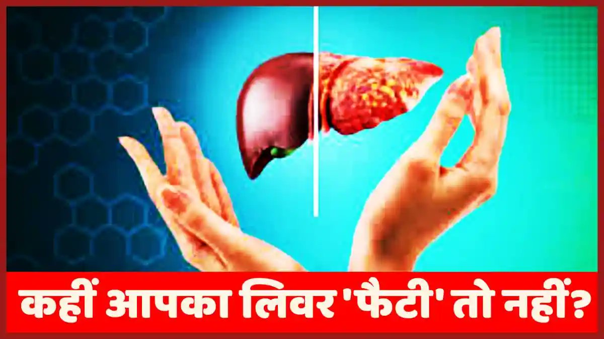 देश का हर तीसरा व्यक्ति फैटी लिवर की समस्या से परेशान, चंडीगढ़ PGI के डॉक्टर से जानें मुख्य कारण और बचाव के उपाय 

पूरी ख़बर पढ़ें - 
etvbharat.com/hi/!bharat/fat… 

#Liver #fattyliver #doctor #health #healthnews #healthday #HealthForAll #HealthTips #healthylifestyle #HealthyHabits