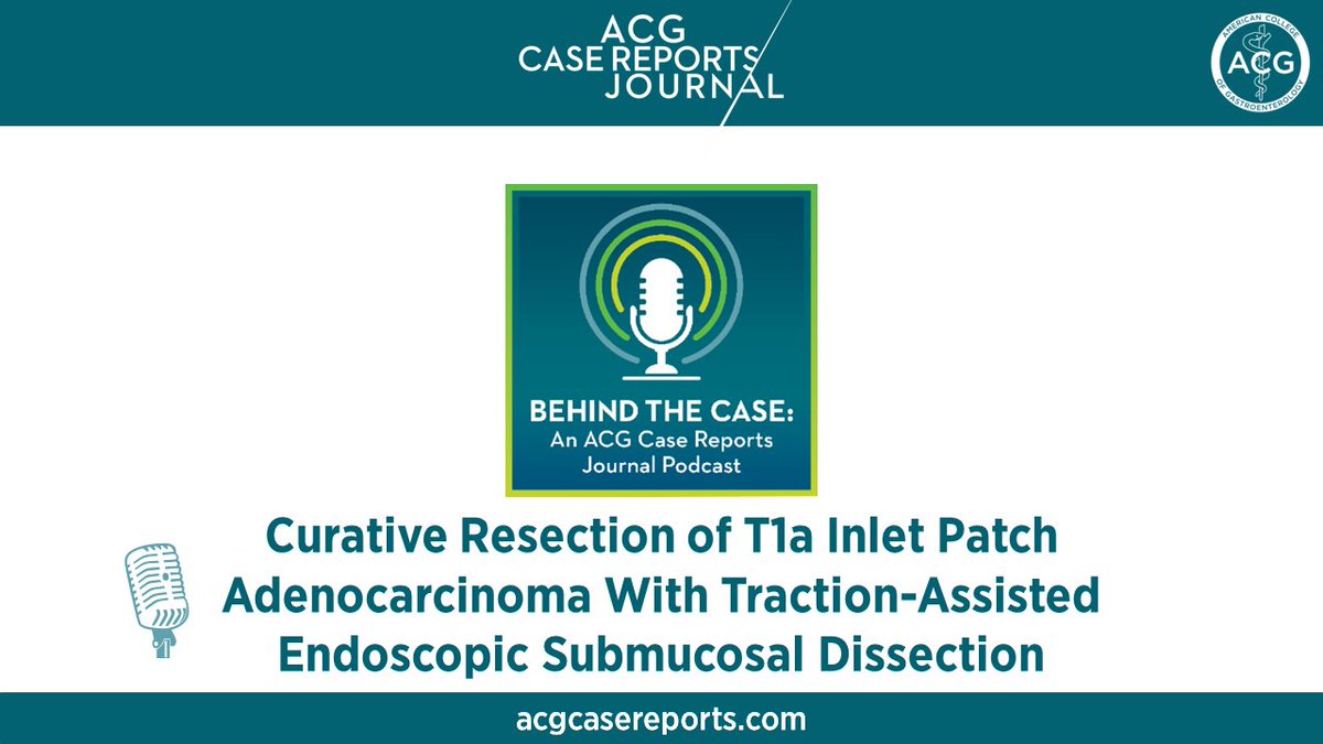 🎙️ Behind the Case Podcast: Curative Resection of T1a Inlet Patch Adenocarcinoma With Traction-Assisted Endoscopic Submucosal Dissection AE Dr. Achintya Singh w/ authors Dr. Firas Bahdi & Dr. Alireza Sedarat ➡️ gi.org/acgcrpodcasts @Achintya_singh4 @bahdi_firas @ASedarat