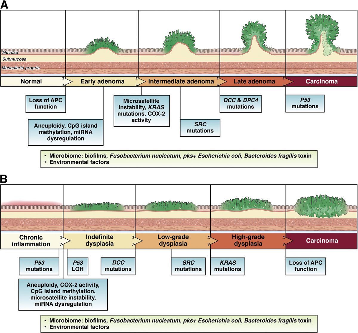 This week's most cited article: #ColorectalCancer in Inflammatory Bowel Disease: Mechanisms and Management -- ow.ly/KavU50R9zbA @ShailjaShahMD @UCSanDiego @MountSinaiNYC #IBD #CrohnsDisease #UlcerativeColitis