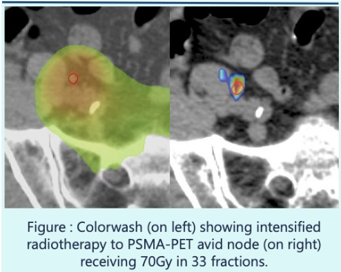 UroToday.com tweet media