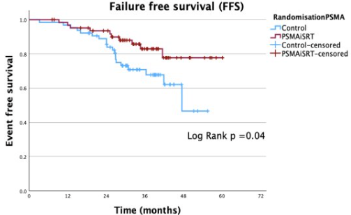 UroToday.com (@urotoday) on Twitter photo PSMA-PET guided intensification of salvage radiotherapy after radical prostatectomy: a phase 2 randomized controlled trial. Presentation by Colin Belliveau, MD <a href="/chumontreal/">CHUM</a>. #EAU24 written coverage by <a href="/RKSayyid/">Rashid K. Sayyid</a> <a href="/UofT/">University of Toronto</a> > bit.ly/3vSu35D <a href="/Uroweb/">European Association of Urology (EAU)</a> PSMA-PET guided intensification of salvage radiotherapy after radical prostatectomy: a phase 2 randomized controlled trial. Presentation by Colin Belliveau, MD <a href="/chumontreal/">CHUM</a>. #EAU24 written coverage by <a href="/RKSayyid/">Rashid K. Sayyid</a> <a href="/UofT/">University of Toronto</a> > bit.ly/3vSu35D <a href="/Uroweb/">European Association of Urology (EAU)</a>