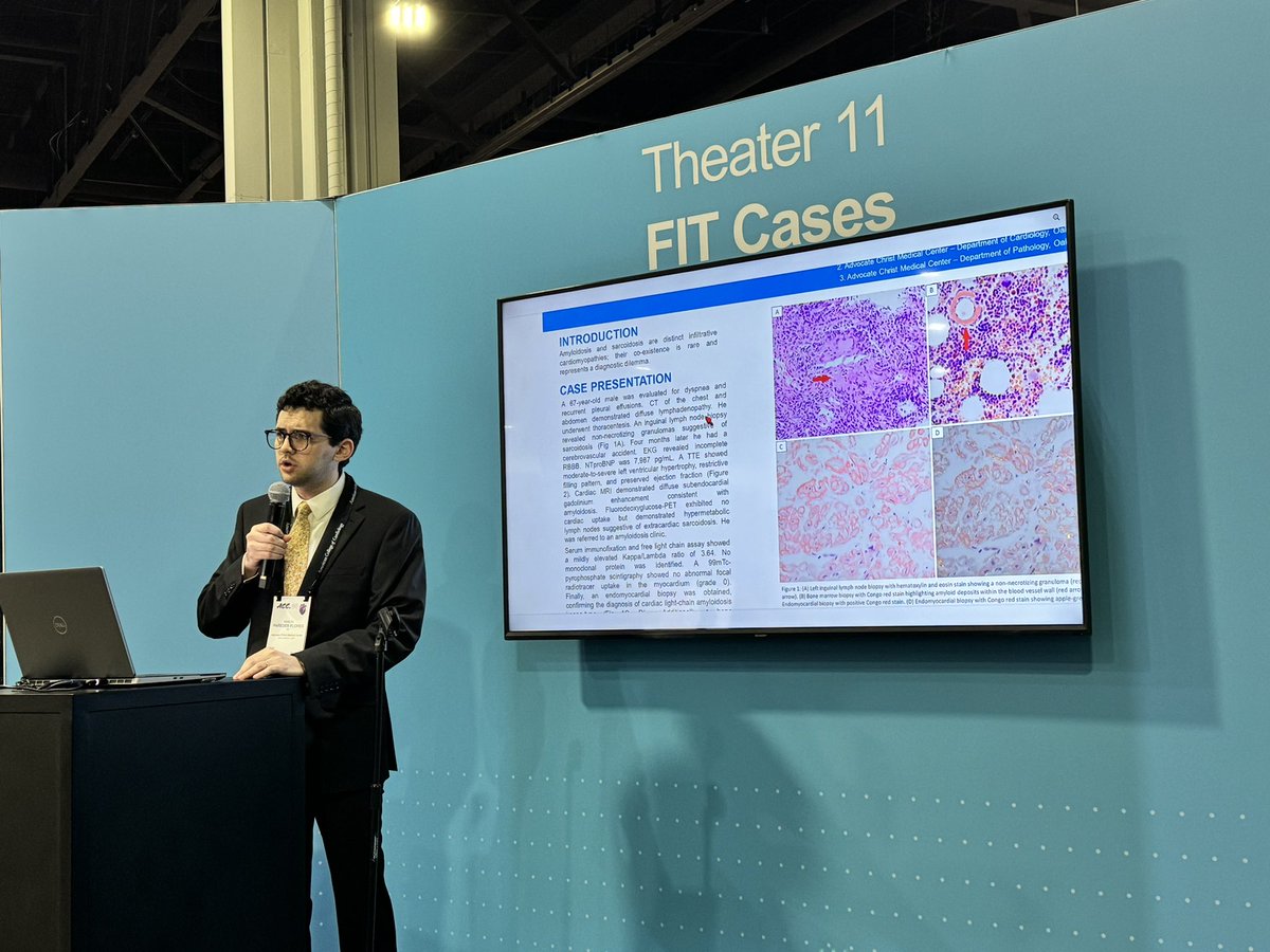 Nikhil Narang, MD (@nikhil15) on Twitter photo Really nice challenging #ACCFIT case by Dr. Manuel Paredes from <a href="/ACMCIMRes/">ACMC IM Residency</a> on two co-existing infiltrative cardiomyopathies with mentorship by <a href="/SPauwaa/">Sunil Pauwaa MD</a> #ACC24 Really nice challenging #ACCFIT case by Dr. Manuel Paredes from <a href="/ACMCIMRes/">ACMC IM Residency</a> on two co-existing infiltrative cardiomyopathies with mentorship by <a href="/SPauwaa/">Sunil Pauwaa MD</a> #ACC24
