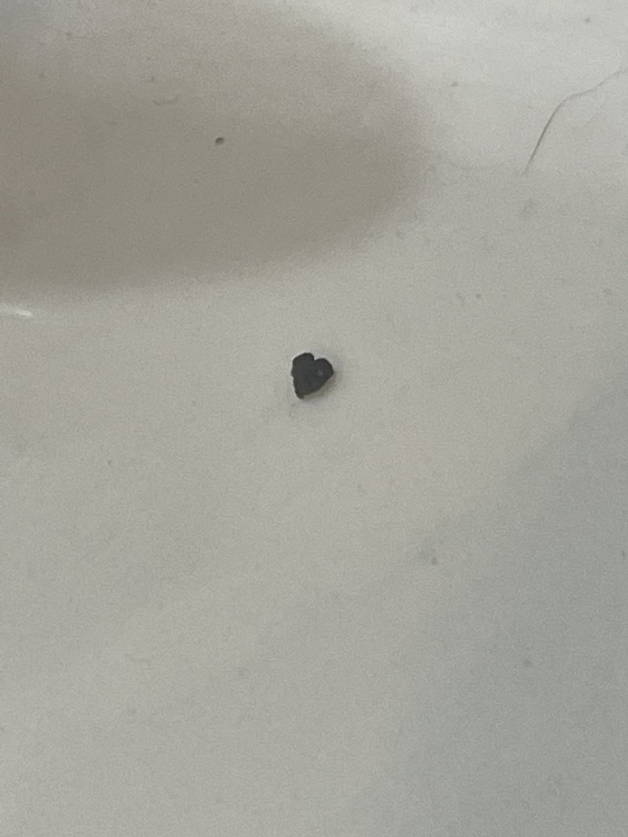 KDEdwards_NC's tweet image. Passed a heart-shaped kidney stone this weekend. Aw, thank you Universe!