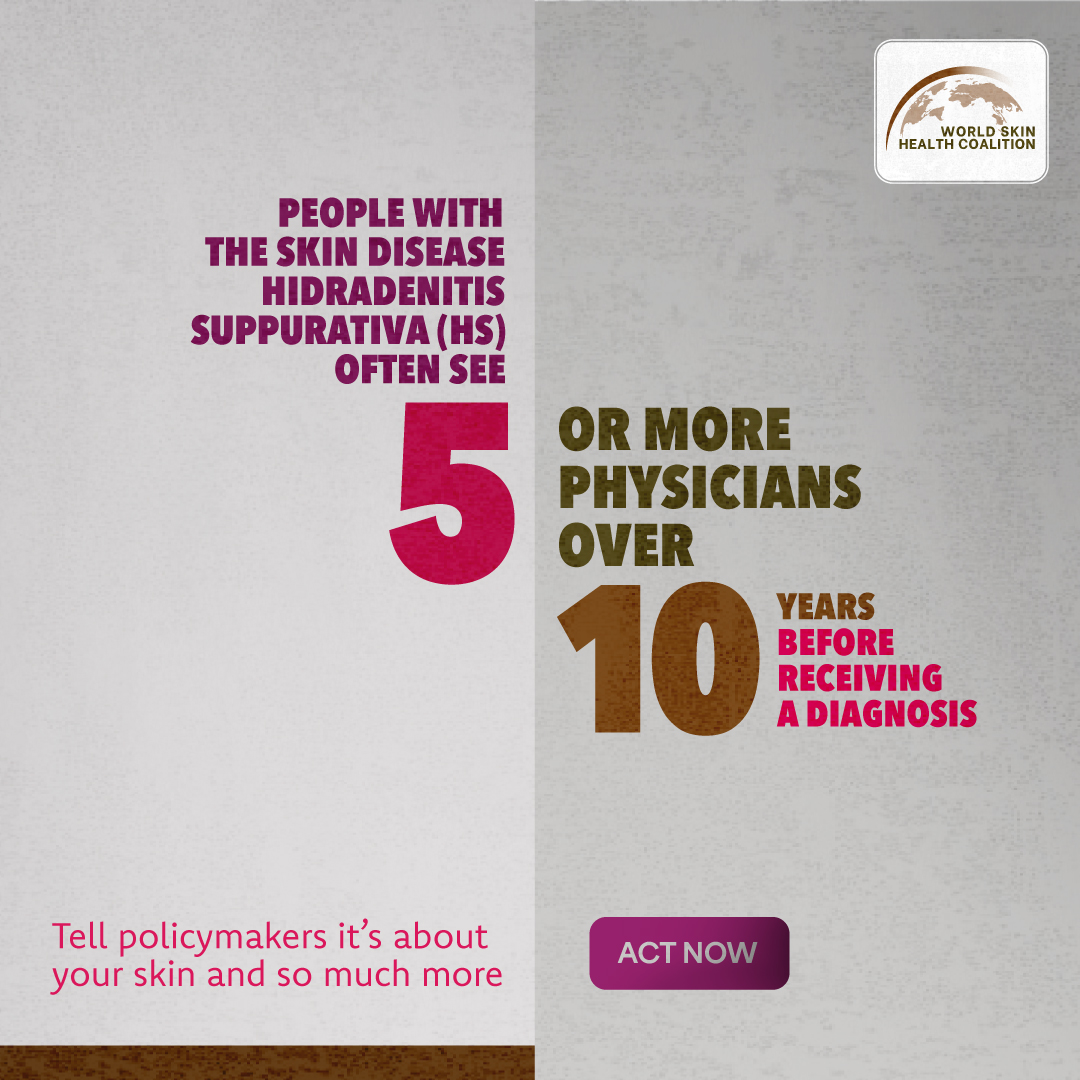 Hidradenitis Suppurativa (HS) Ireland tweet media