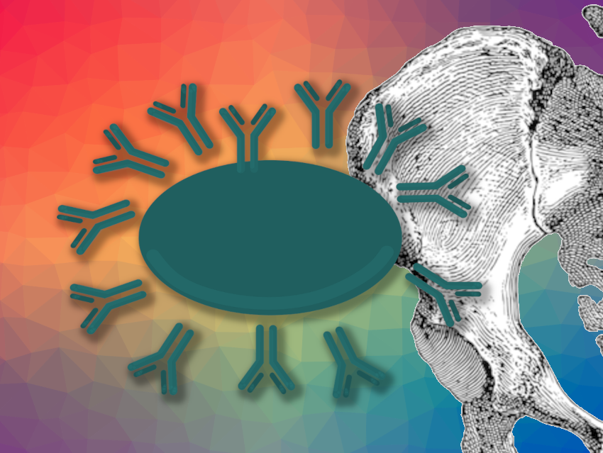 Fleeting Protection of SARS-CoV-2 Vaccines Due to Short-Lived Plasma Cells: Limited presence of long-lived plasma cells targeting COVID-19 in bone marrow may explain lack of long-term immunity chemistryviews.org/fleeting-prote…