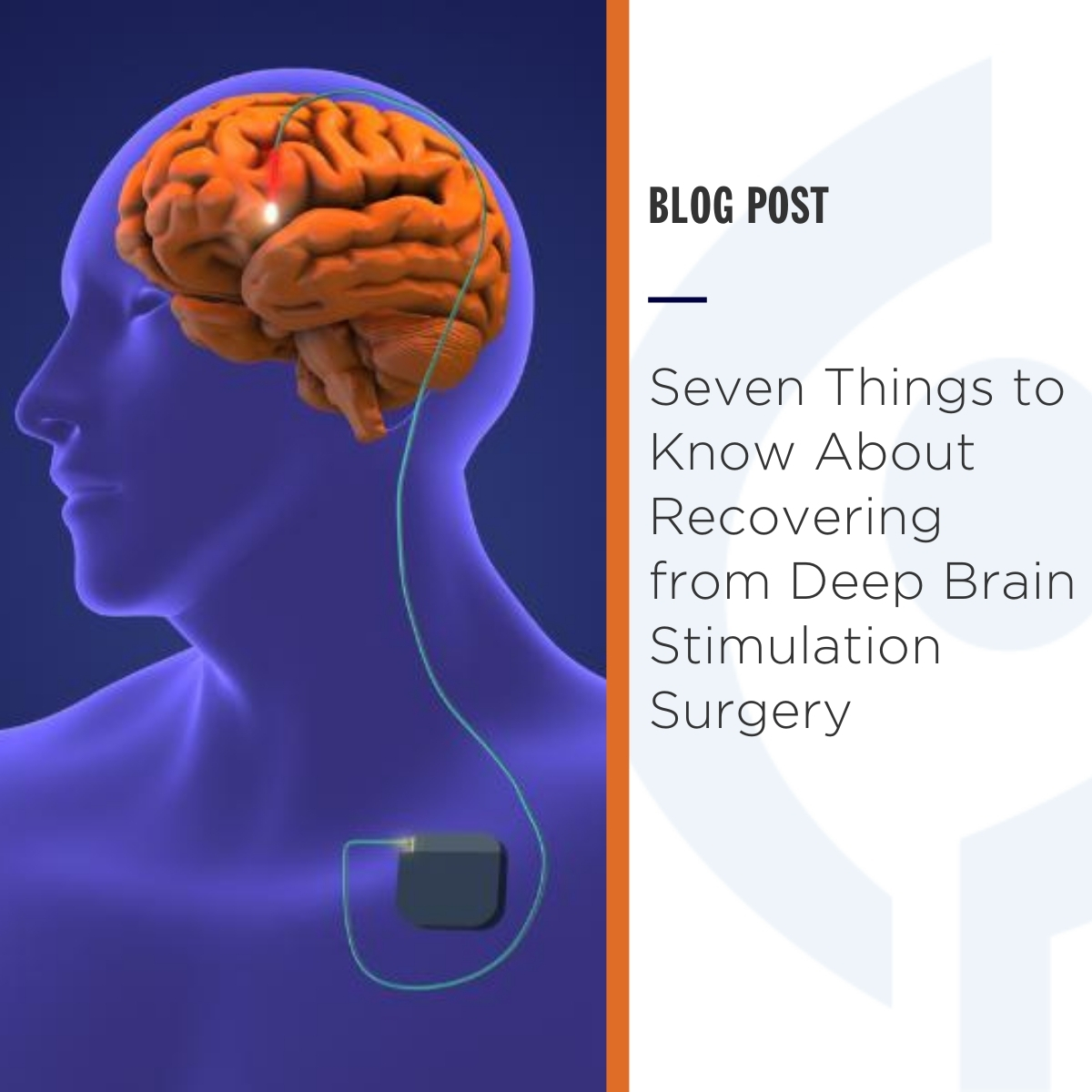 Getting started with deep brain stimulation (#DBS) involves multiple steps, and the full process almost always involves several #surgical procedures. Read the blog for seven other things to know about #recovery from DBS #surgery: bit.ly/49rQAUT
