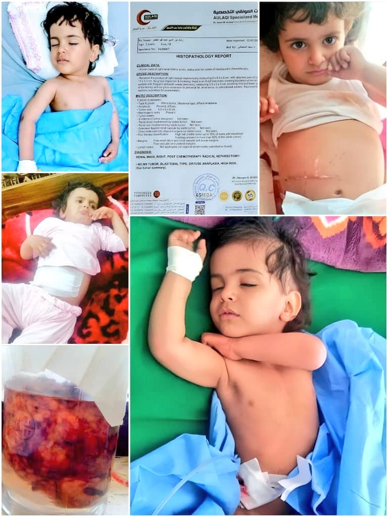 📢#DonateOrShare🤲🏼 Donate -Donate -Donate Everyone please donate to this appeal. The least you can do is repost InshaAllah. We are raising funds to help the baby Rashad to defeat the cancer. 👇🔄 gofund.me/755c6dab #LaylatulQadr #Zakat #EidAlFitr #Eid2024 #EidMubarak #Eid