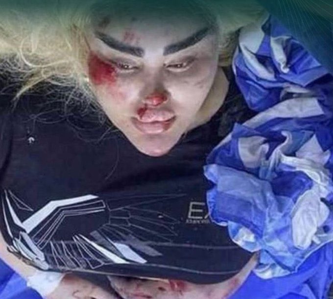 1NIAW's tweet photo. They assaulted and raped her.. The Iraqi journalist #Dalia_Naeem was found hours after she was kidnapped on the side of the road, with signs of beating and burns on her.
Note: The video attached to the tweet is the moment she was kidnapped in front of her house https://t.co/RceDuUQsLZ