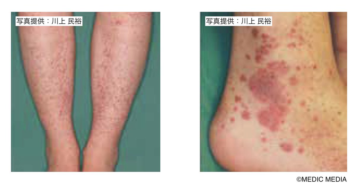 GKmq_LkawAAXYes.jpg?format=jpg