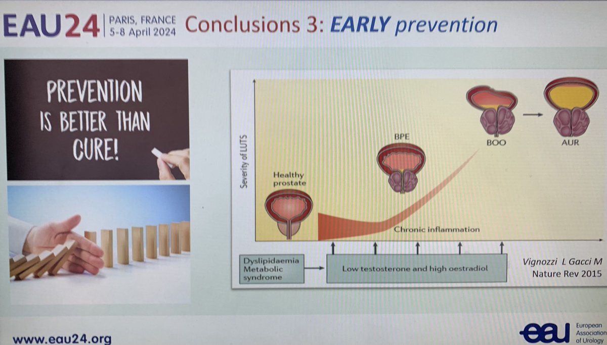 Incredible talk by ⁦@MauroGacci⁩ at #EAU24 #Paris about prevention of benign prostatic disease - truth an lies about diet, sex, physical activity and more ⁦@Uroweb⁩ ⁦@cgratzke⁩