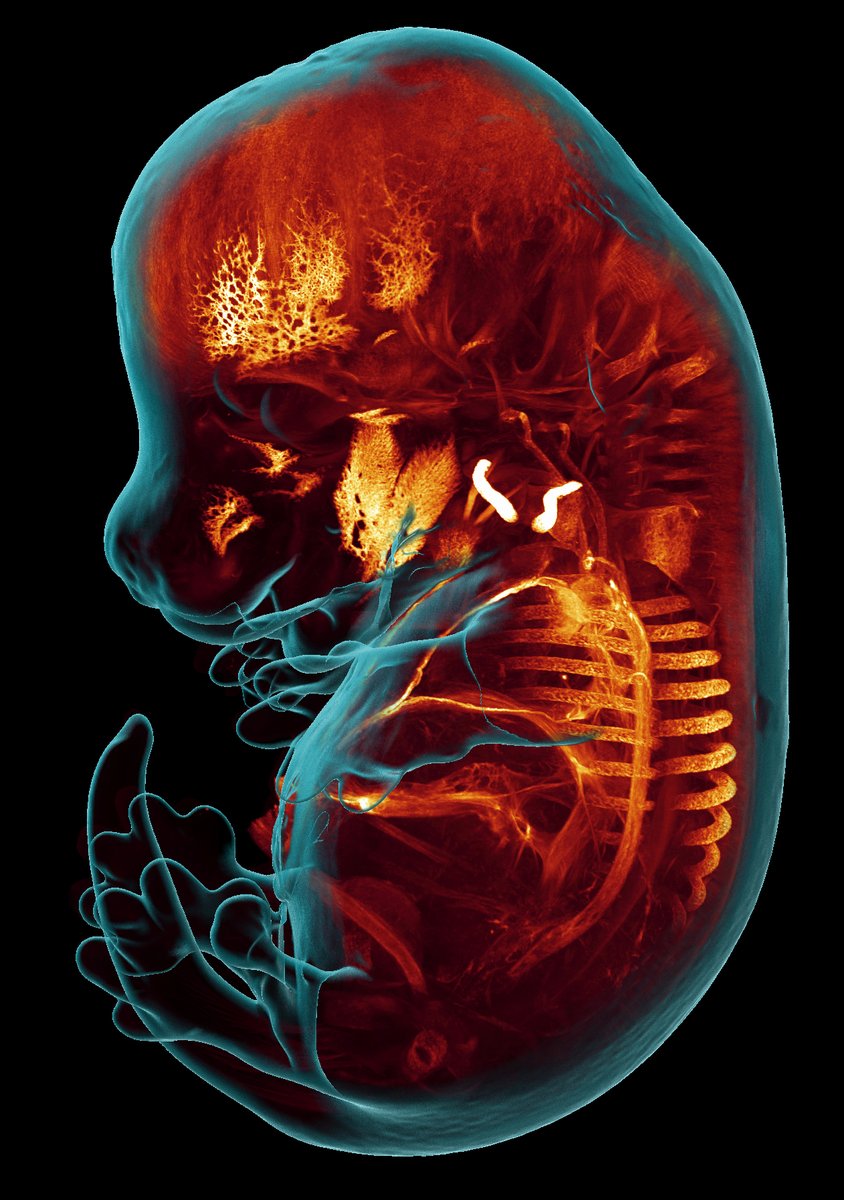 Check out Grigorii & Michel's mouse embryo that won the @CiteAb's Image of the Year. This sample was prepared with our fast green collagen staining method and imaged using light sheet microscopy 🐭🔬 lanevol.org/news/article/w… @UNIGEnews @sciences_UNIGE @genevunige