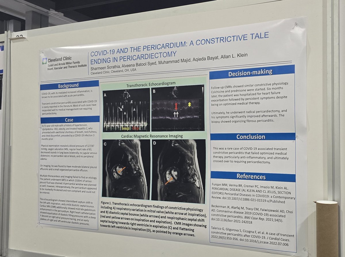 Had a memorable expereince at #ACC24 presenting a rare and interesting case of contrictive pericarditis related to COVID-19, with @AllanLKleinMD1. So much to learn from Dr Klein's renowned experience in pericardial diseases.