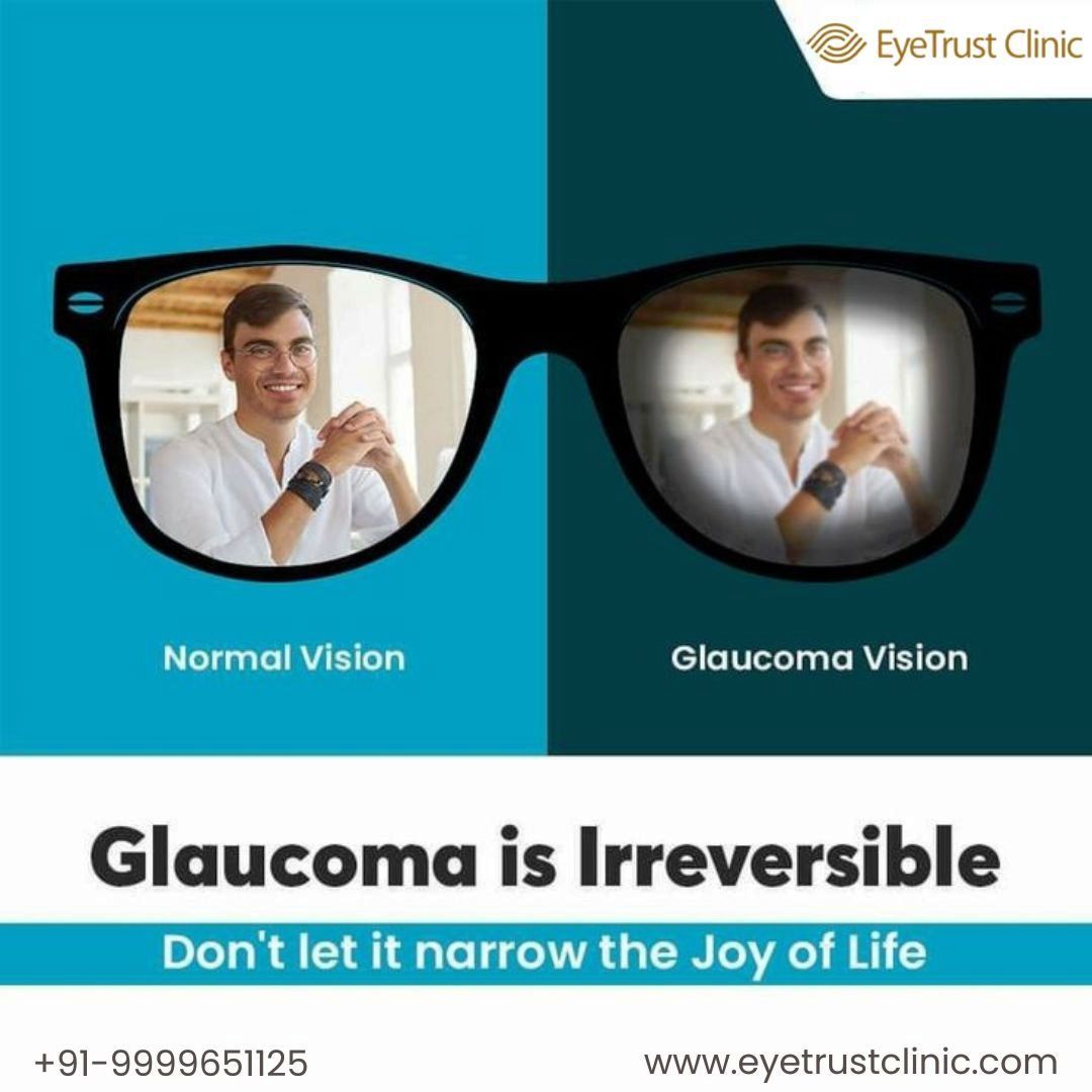 🏥 Eye Trust Clinic is here to provide you with expert Glaucoma treatment. Regain clarity and brightness in your world! 🌈
👩‍⚕️Book your consultation today!
Contact:(+91)-9999651125, (+91)-8377096565
Visit:eyetrustclinic.com
#GlaucomaTreatment #EyeTrustClinic #GlaucomaSurgery