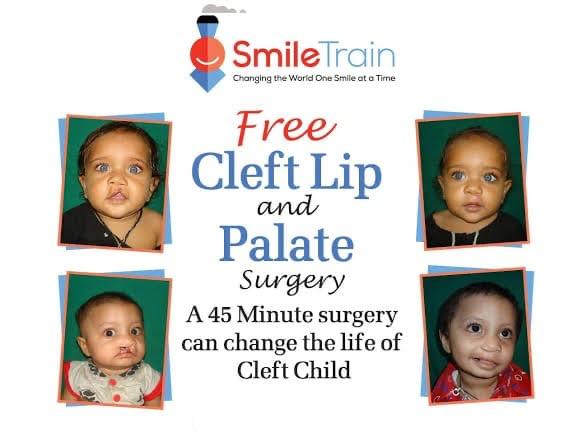 Help Uttarakhand Group (@bharat24588032) on Twitter photo #Free_cleftsurgery and care
Smile Train is providing Free cleft surgery and care
Find Smile Train Treatment Centre all Over India
👇
smiletrainindia.org/find_help
<a href="/PrernaSrivasta/">Prerna Srivastava🇮🇳</a>
<a href="/Samaachaar_r/">Social_Tea 🇮🇳</a>
<a href="/thesks24/">SKS (Malak of Bharat )</a>
<a href="/Shivani15691817/">Shivani yadav</a>
<a href="/gounder_ramya/">GounderRamya</a>
<a href="/PrashantSahyog/">Prashant Krishna Gaur</a>
<a href="/rishi7_roy/">Rishi Roy</a>
<a href="/AskRoushan/">Roushan Raj</a> #Free_cleftsurgery and care
Smile Train is providing Free cleft surgery and care
Find Smile Train Treatment Centre all Over India
👇
smiletrainindia.org/find_help
<a href="/PrernaSrivasta/">Prerna Srivastava🇮🇳</a>
<a href="/Samaachaar_r/">Social_Tea 🇮🇳</a>
<a href="/thesks24/">SKS (Malak of Bharat )</a>
<a href="/Shivani15691817/">Shivani yadav</a>
<a href="/gounder_ramya/">GounderRamya</a>
<a href="/PrashantSahyog/">Prashant Krishna Gaur</a>
<a href="/rishi7_roy/">Rishi Roy</a>
<a href="/AskRoushan/">Roushan Raj</a>